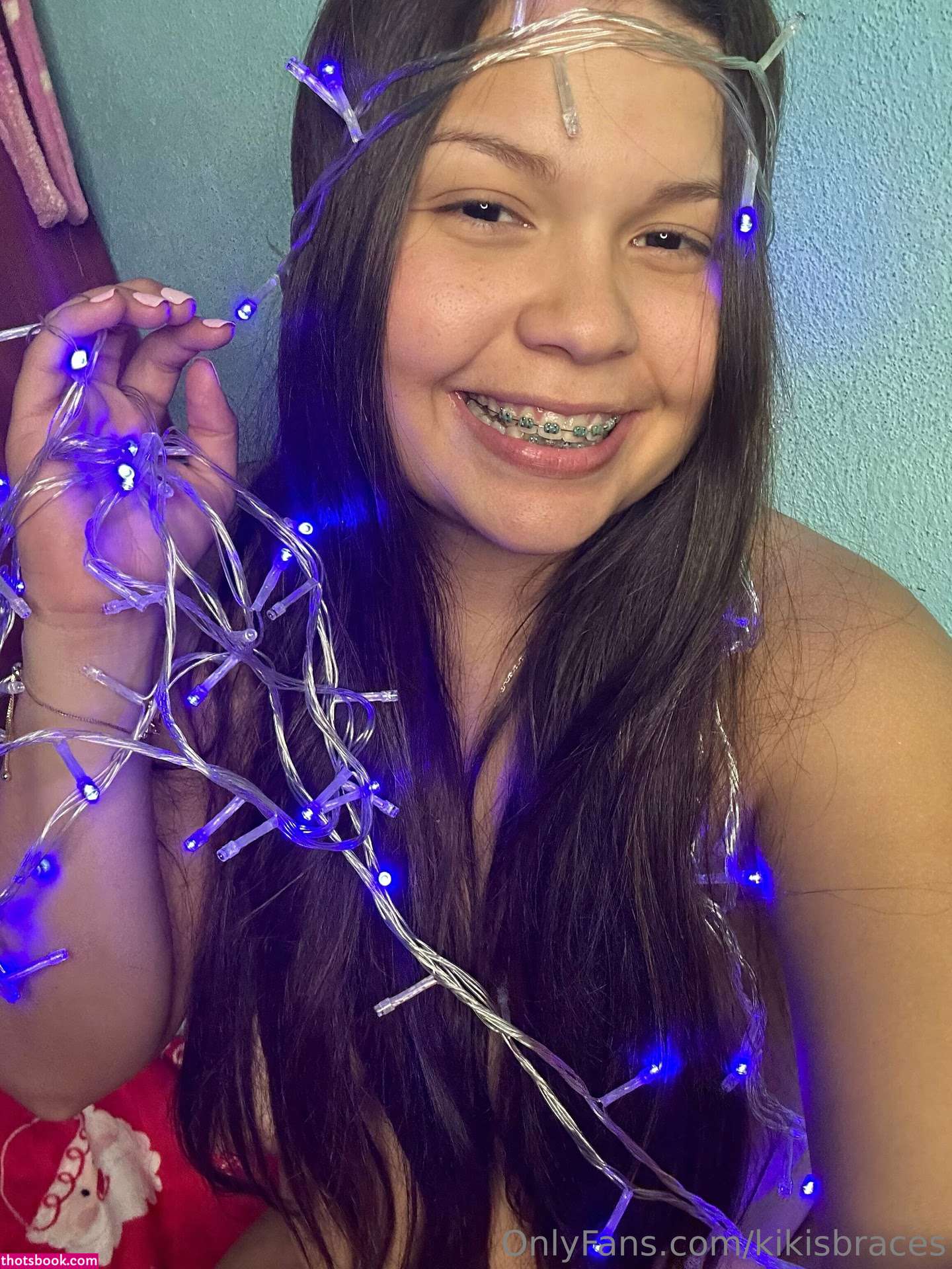 kikisbraces Photo #87