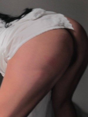 hypothxxcajal Photo #7