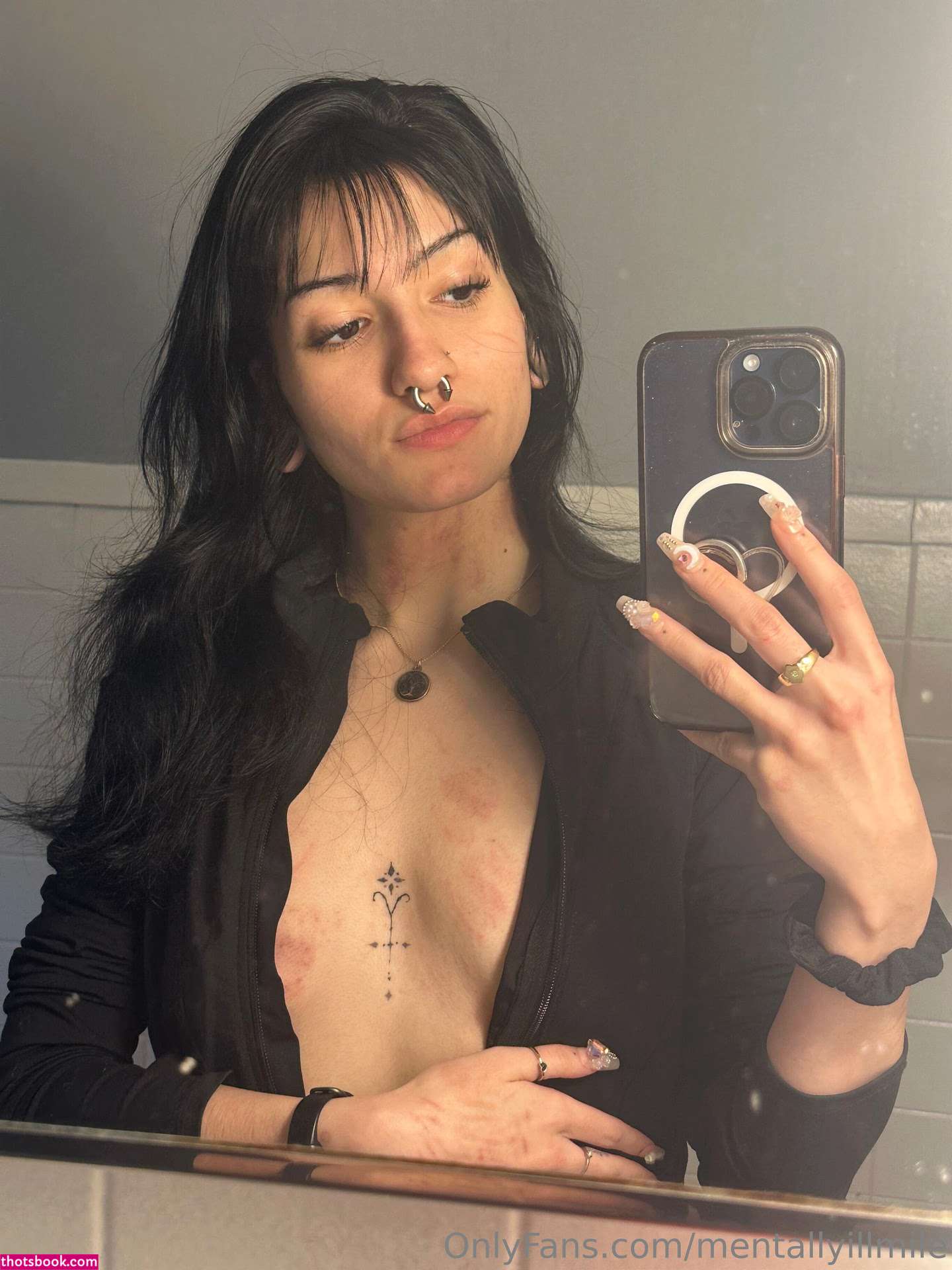 Mentallyillmile Photo #7