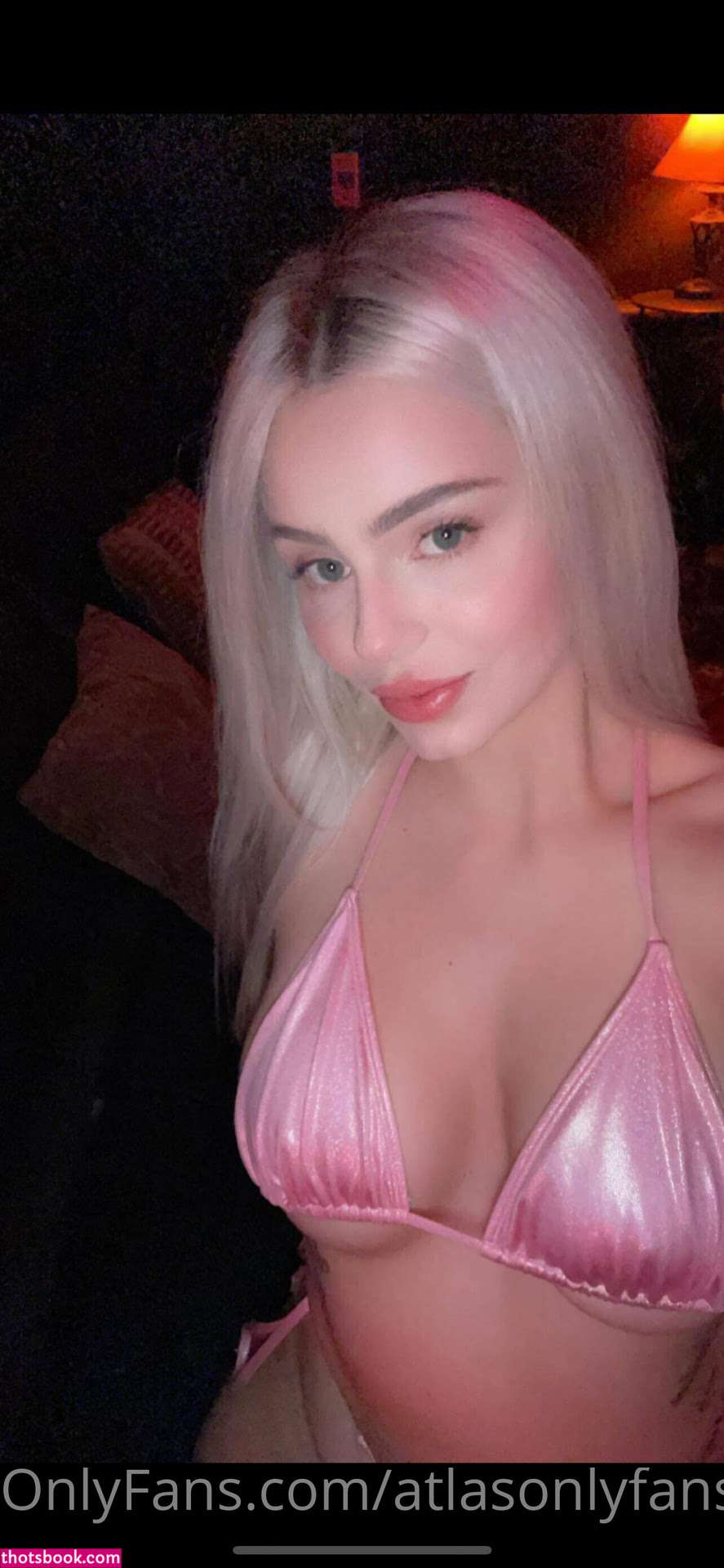 Atlas Anatomy Photo #2