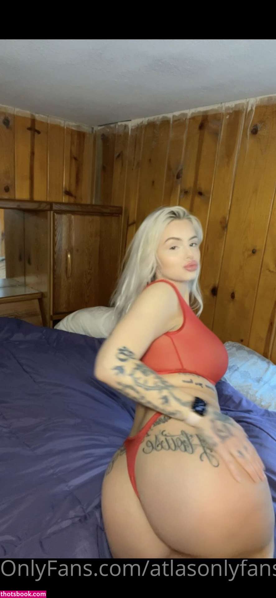 Atlas Anatomy Photo #10