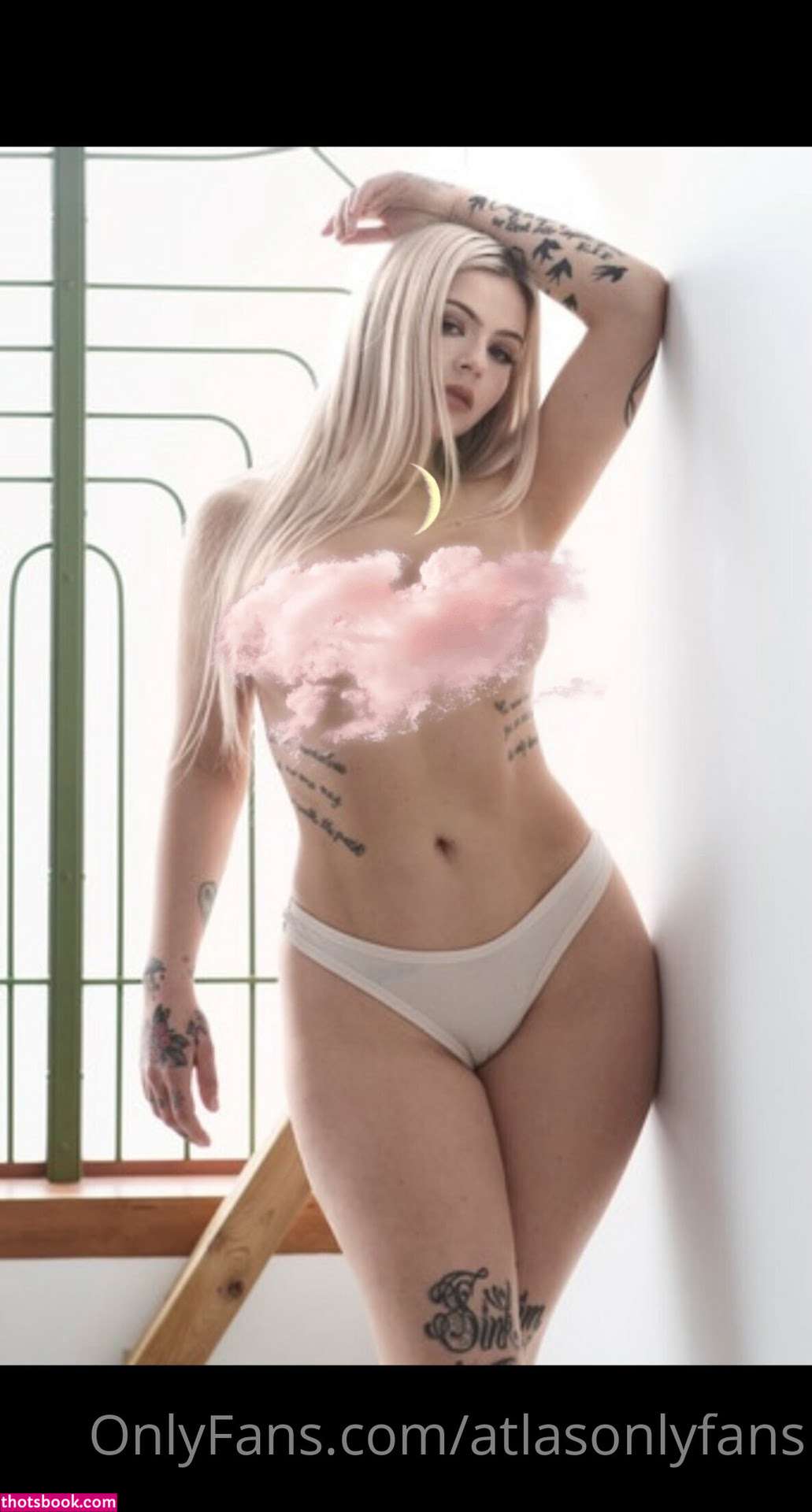 Atlas Anatomy Photo #30