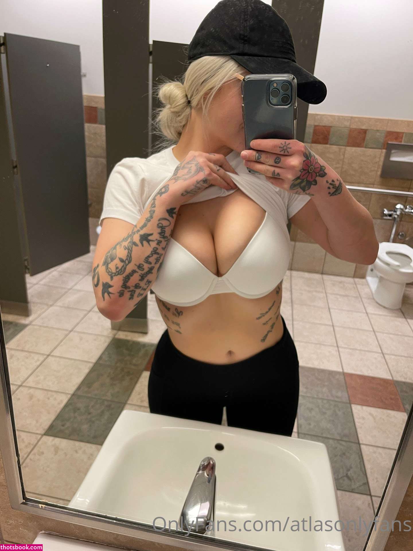 Atlas Anatomy Photo #38