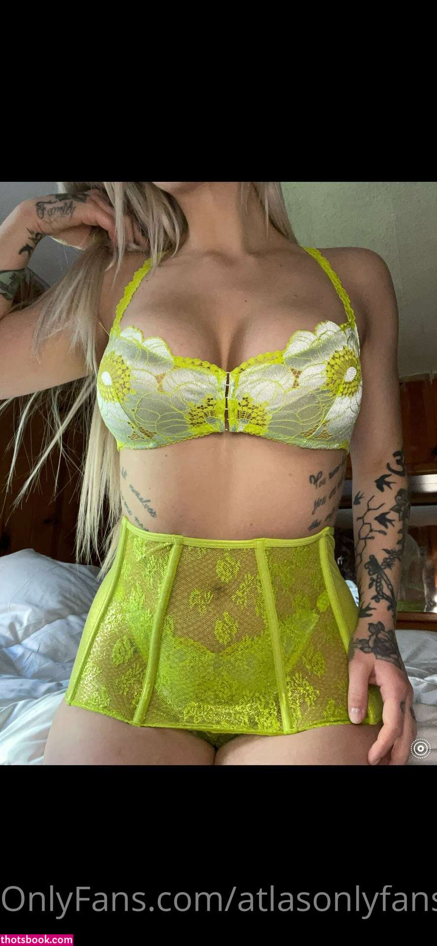 Atlas Anatomy Photo #46