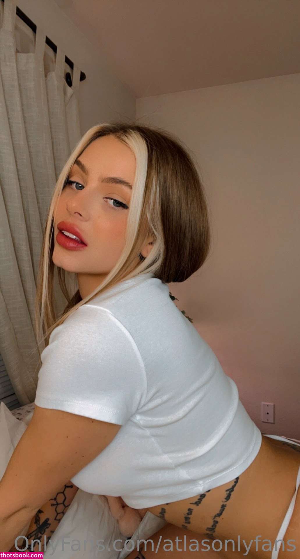 Atlas Anatomy Photo #151