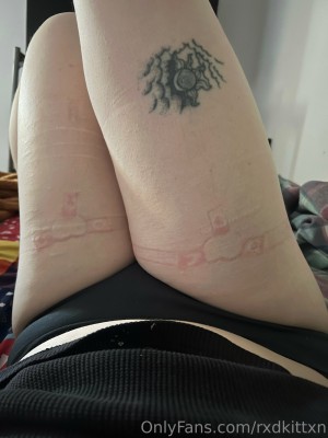 Rxdkittxn Photo #168