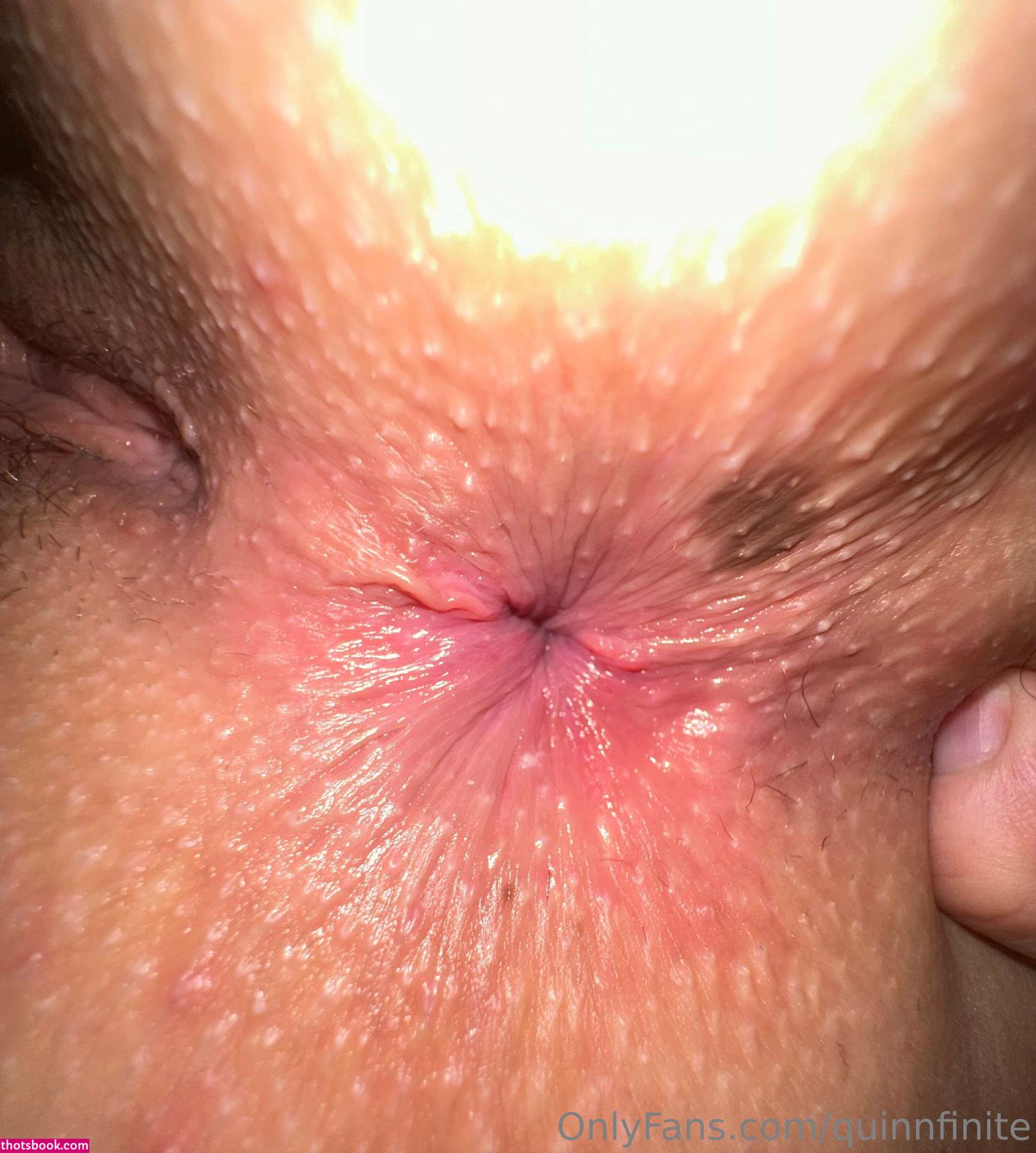 Quinn Finite Photo #318