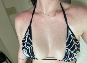 sexymigraines Photo #6